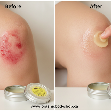 Ouch First Aid Salve. Beeswax+herbal oils 1oz