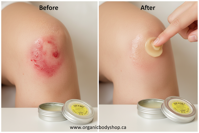 Ouch First Aid Salve. Beeswax+herbal oils 1oz